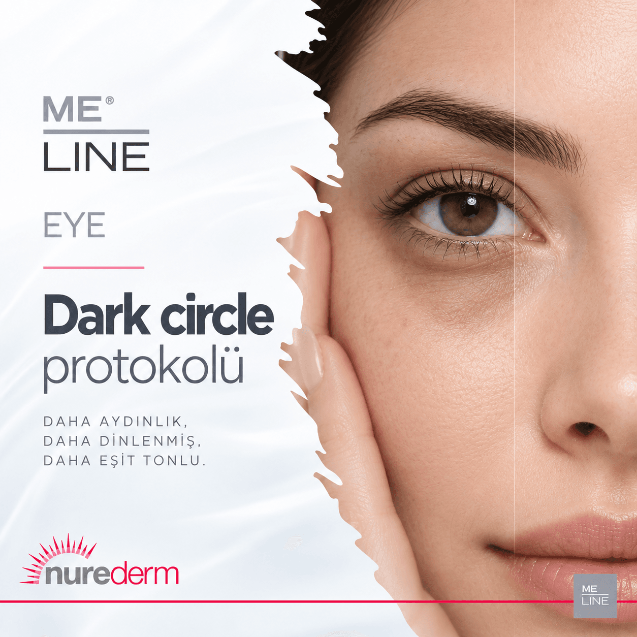 ME Line Dark Circle
