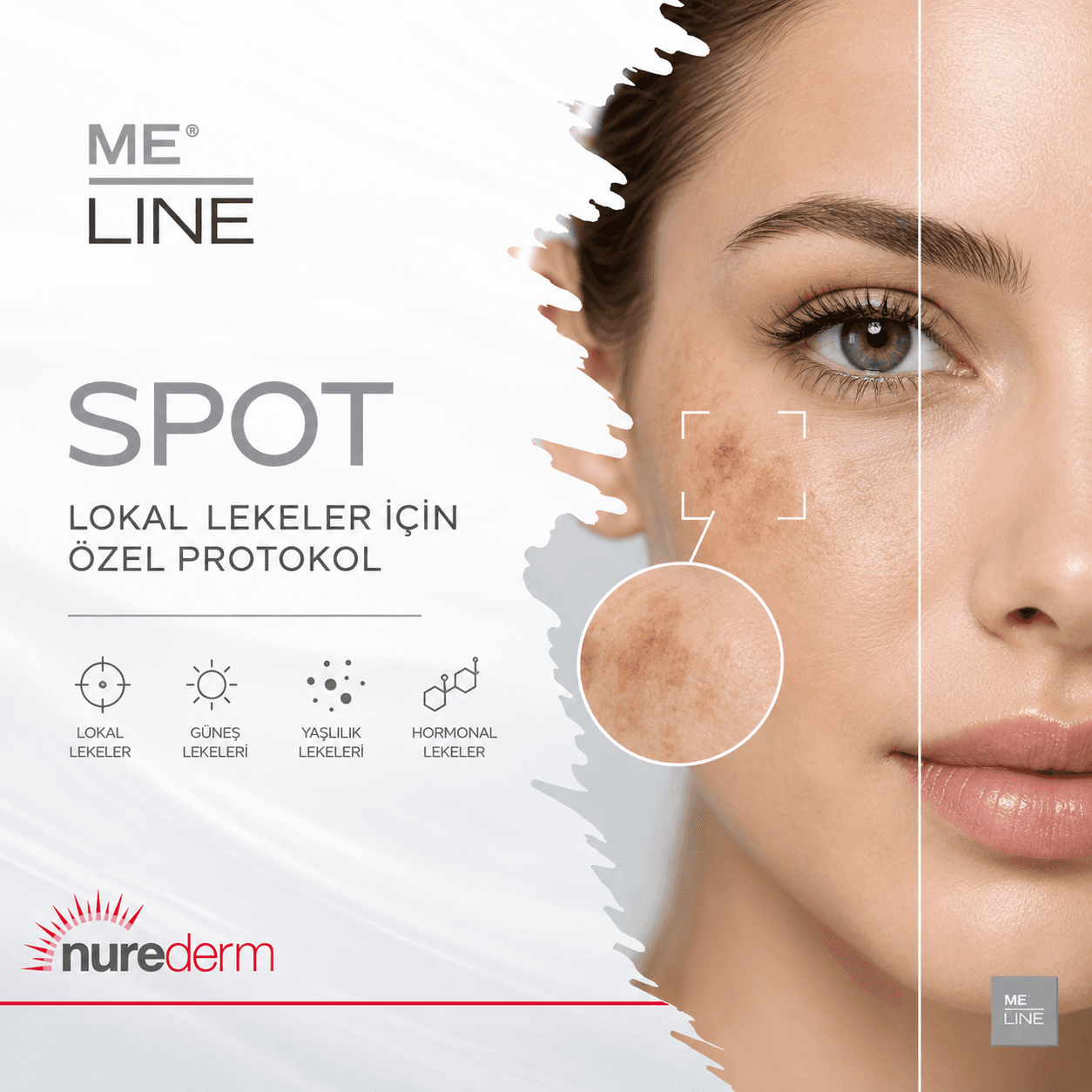 ME Line Spot